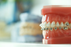 airway orthodontics