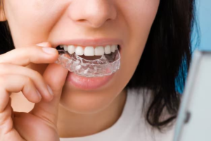 Best Teeth Straightening For Adults